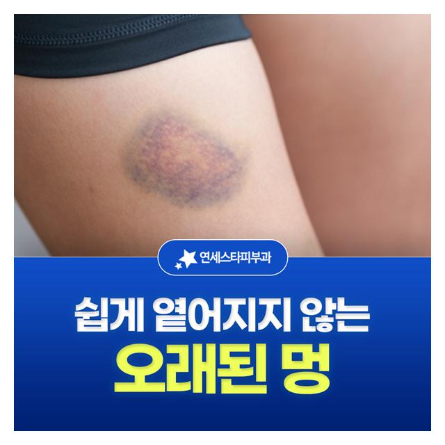 쉽게 옅어지지 않는 오래된 멍도 치료 계획을 잘 세워 제거합니다